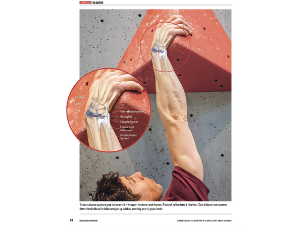 Klatrebibelen - Håndtere klatreskader En praktisk Guide 